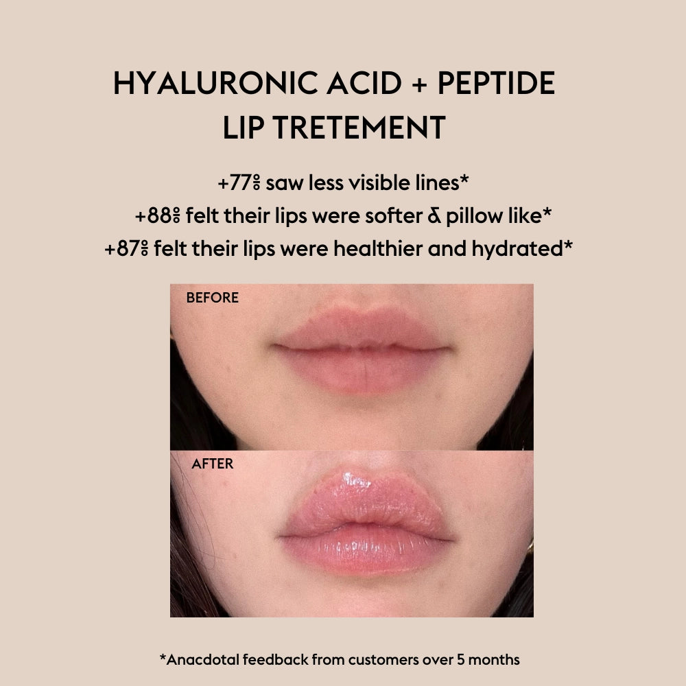 Alfie Hyaluronic + Peptide Lip Treatment